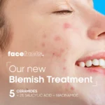 face facts ceramide blemish gel moisturizer in abuja nigeria