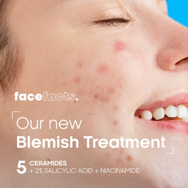 face facts ceramide blemish gel moisturizer in abuja nigeria