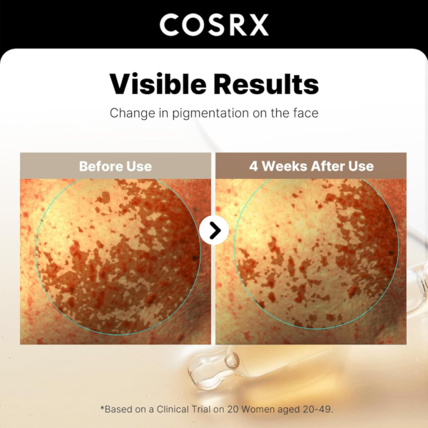cosrx alpha arbutin discoloration works-before and after