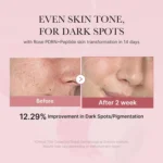 Medicube PDRN Pink Niacinamide Milky Toner benefits