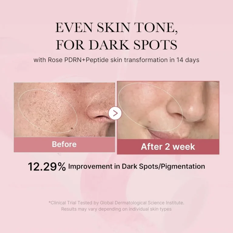 Medicube PDRN Pink Niacinamide Milky Toner benefits