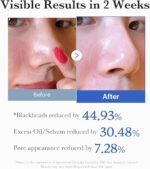 Medicube Zero Pore Pads 2.0 [2025 Version] - 70 pads - Image 2